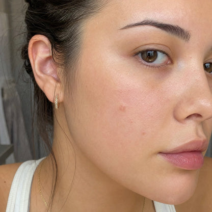 Hydrocolloid pimple patches